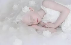 有白化病可以试管吗?有白化病能不能选男女?