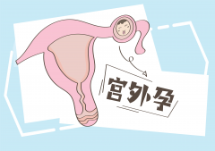 宫外孕手术：揭秘风险与康复之旅，让你心中有数！