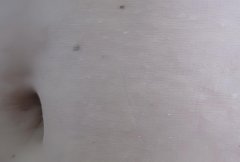 孕妇肚脐眼黑是怎么回事?孕妇肚脐眼黑是病吗?