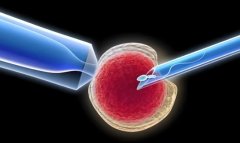 试管需要刮宫吗?试管刮宫疼不疼?