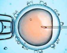 试管，那些必做的检查项目