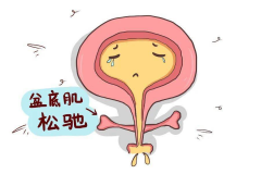 剖腹产揭秘：盆底肌松弛的真相，最新研究让你大开眼界！