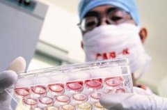 试管怀双胞胎几率高吗