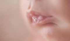 新生儿吐暗红色血奶是怎么回事?新生儿吐暗红色血奶是什么问题?