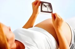 孕期检查免费的是哪些?孕期检查免费的项目