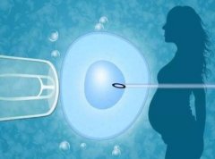 医学科普｜这样做可提高试管的成功率