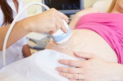 试管 | 孕早期NT筛查的意义