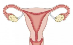 子宫纵膈试管成功率有多少？一般30%-50%