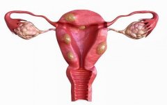 患有子宫肌瘤会影响怀孕、会降低试管成功率吗？