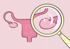 卵巢功能差也能做试管，事前准备非常重要！