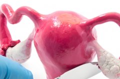 多囊卵巢怎么办?能不能通过试管怀孕?