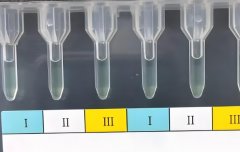 不规则抗体是什么?不规则抗体孕期要做几次?