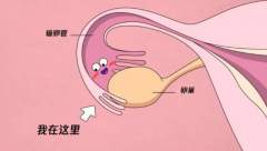 试管与输卵管健康：关键要求与必要检查，共筑好孕桥梁