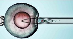 染色体异常，做第三代试管成功率高吗？