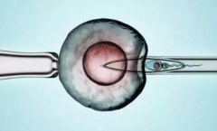 胚胎移植后这样做精准提高好孕率！