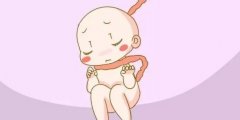 担心胎儿脐带绕颈？平时做好这些方面能避免！