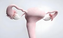 子宫附件囊肿严重吗?会不会自愈?