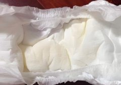 新生儿尿液黄是病吗?婴儿尿液黄治疗方法