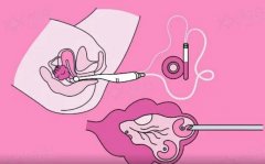 孕育解答 | 我已经开始进入周期了，多久才能取卵呢？