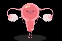 子宫肌壁薄有什么办法?子宫肌壁薄怎么办?