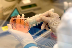 试管移植成功后的细心呵护：不容忽视的细微之处