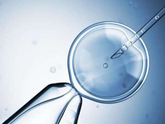 试管全攻略：从零到精通，方案选择与注意事项详解