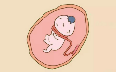 胎儿脐带绕颈一周很危险吗？怎么预防脐带绕颈？