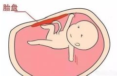 试管胎盘能吃吗？看完你绝对不会乱吃！