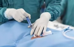 试管也会导致宫外孕?小心有生命危险!