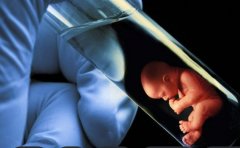 试管导致内膜异位到底是什么？如何预防？