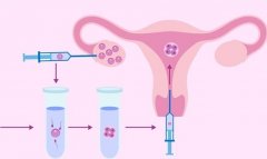 取卵后出现“腹水”，别慌，你该这么做！