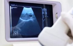 人工受孕的流程是怎么样的?人工受孕需要多长时间?