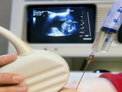 试管全程揭秘：从启动到成功，所需时间与关键步骤概览