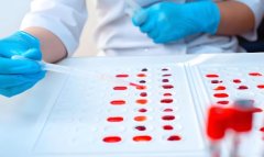 试管胎停后需要刮宫吗?试管胎停后要注意什么?