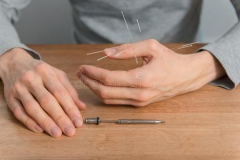 男性备孕能不能做针灸？对于生育有好处