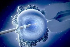 子宫切除后，试管的可能性揭秘：专业解答您的疑问！