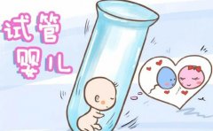 试管三代囊胚移植介绍，试管三代囊胚移植有哪些风险和副作用？