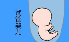 试管移植有哪些步骤？需要注意哪些事项？
