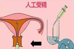 专业医院助力人工授精，科学选择性别服务，圆您家庭梦想