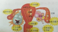 温州输卵管堵塞专科医院：打造最先进的诊断和治疗设备
