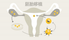 移植后尿多：除着床怀孕外，这一变化为何同样值得细心观察与重视？
