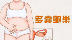 西宁多囊卵巢治疗指南：精选专科医生与医院的实用攻略