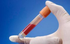 做试管要多久？能不能快一点？关键要看它！