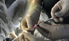 广西试管有什么优惠?试管费用太高怎么办?