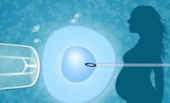 一文了解全国试管排名前10位医院概况