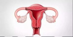 一文了解如何判断自己是宫腔积液还是着床成功？