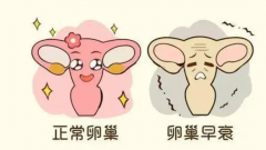 掌握这4个妙招，拯救卵巢不是梦！
