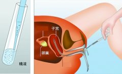 北京不孕不育医院排行榜揭晓，你知道哪些名列前茅吗？