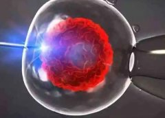 试管需要怎么做?试管要注意什么?