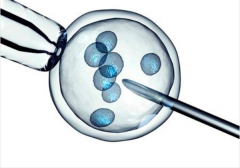 格鲁吉亚试管优选方案指南，关键注意事项与时间安排全解析